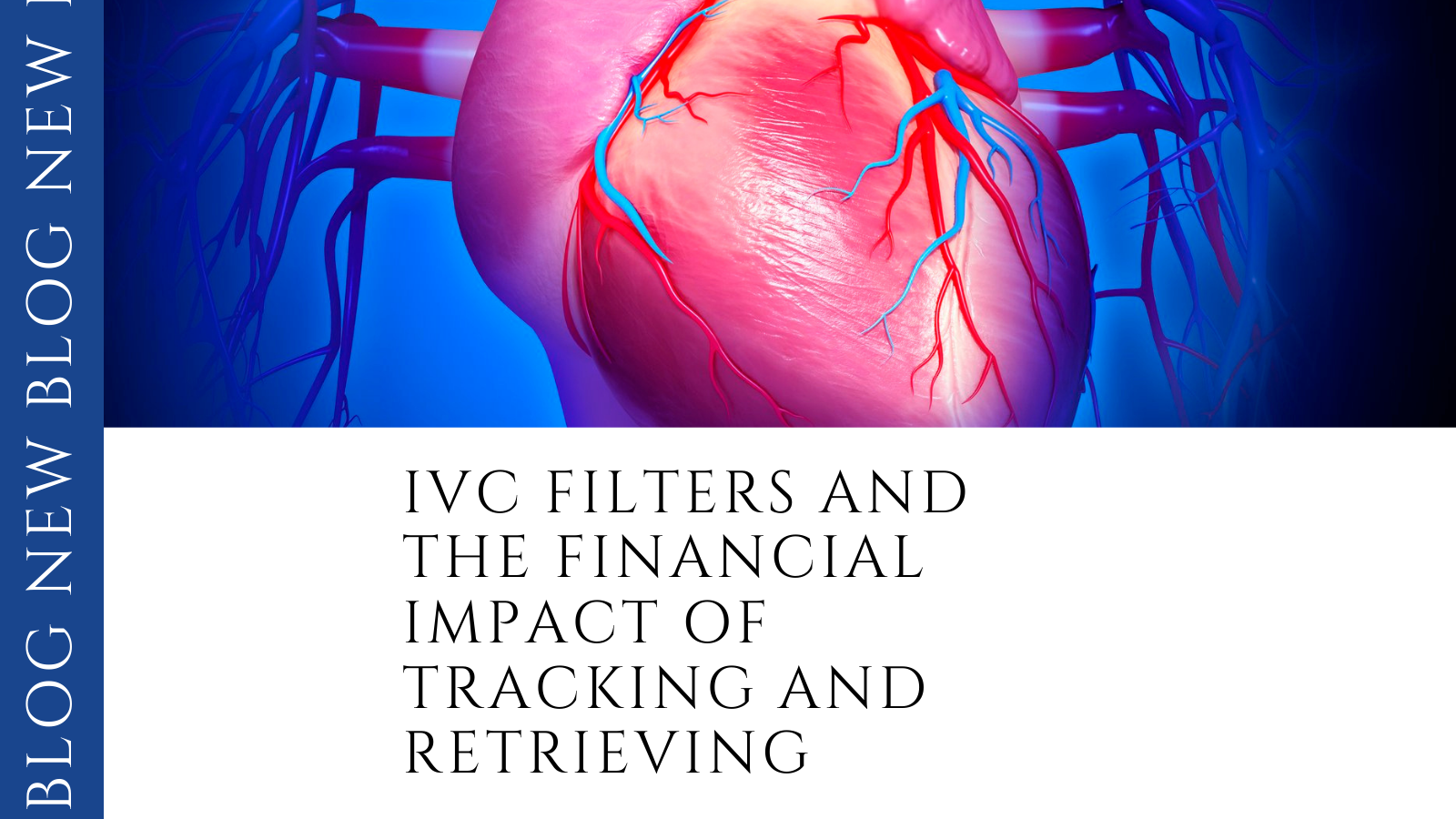 IVC Filters Blog Post by CAREier